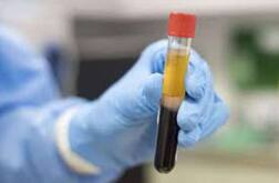 ਕੋਰੋਨਾ ਦੇ ਕਹਿਰ 'ਚ ਕੇਜਰੀਵਾਲ ਨੇ ਸੁਣਾਈ ਰਾਹਤ ਦੀ ਖ਼ਬਰ, ਪਲਾਜ਼ਮਾ ਥੈਰੇਪੀ ਬਣ ਰਹੀ ਵਰਦਾਨ