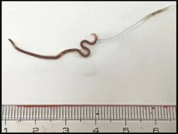 25 ਸਾਲਾ ਔਰਤ ਦੇ ਗਲ 'ਚੋਂ ਨਿਕਲੀ ਇਹ ਚੀਜ਼ ਦੇਖ ਕੇ ਰਹਿ ਜਾਵੋਗੇ ਹੈਰਾਨ, ਡਾਕਟਰ ਵੀ ਸੋਚਾਂ 'ਚ ਪਏ