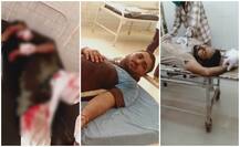 ਪਿੰਡ ਗੁਰੂਸਰ ਵਿੱਚ ਨੌਜਵਾਨਾਂ 'ਚ ਹੋਈ ਖੂਨੀ ਝੜਪ, ਕਈ ਜ਼ਖ਼ਮੀ ਹਸਪਤਾਲ 'ਚ ਭਰਤੀ