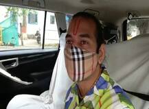 ਪਿਤਾ ਲਾਲੂ ਪ੍ਰਸਾਦ ਯਾਦਵ ਨੂੰ ਮਿਲਣ ਗਏ ਤੇਜ ਪ੍ਰਤਾਪ ਯਾਦਵ 'ਤੇ FIR ਦਰਜ, ਆਖਿਰ ਕੀ ਹੈ ਮਾਮਲਾ?