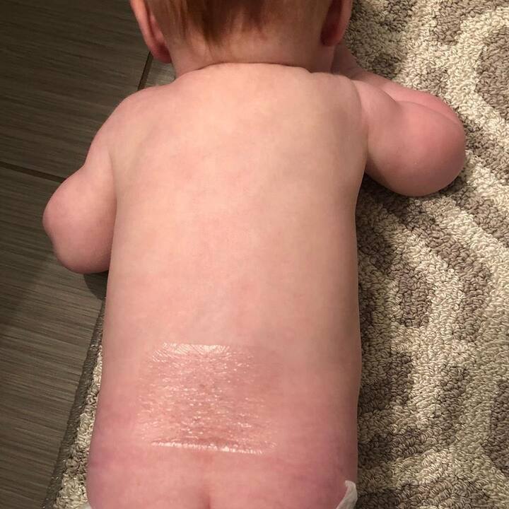 ਨੀਰੂ ਨੇ ਸੋਸ਼ਲ ਮੀਡੀਆ 'ਤੇ ਇਸ ਬੱਚੀ ਦੀ ਤਸਵੀਰਾਂ ਸ਼ੇਅਰ ਕਰ ਲੋਕਾਂ ਨੂੰ ਇਸ ਦੀ ਮਦਦ ਕਰਨ ਲਈ ਕਿਹਾ ਹੈ। ਹਾਰਪਰ ਦੇ ਇਲਾਜ ਲਈ 2.8 ਮਿਲੀਅਨ ਡਾਲਰ ਦੀ ਜ਼ਰੂਰਤ ਹੈ। ਇਸ ਤੋਂ ਪਹਿਲਾ ਵੀ ਨੀਰੂ ਨੇ ਆਰੀਅਨ ਦੇ ਇਲਾਜ ਲਈ ਮਦਦ ਕੀਤੀ ਸੀ।