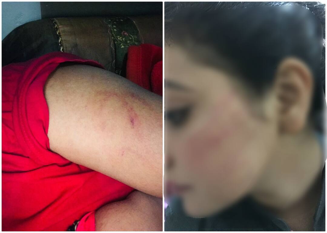 Sikh girl Manmeet Kaur exposed Pakistan for getting acid attack threat on social media ਪਾਕਿਸਤਾਨ 'ਚ ਸਿੱਖ ਲੜਕੀ ਮਨਮੀਤ ਕੌਰ ਨੂੰ ਧਮਕੀਆਂ ਦਾ ਸੱਚ ਆਇਆ ਸਾਹਮਣੇ