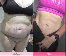 ਮੋਟਾ ਪੇਟ ਖਤਰੇ ਦੀ ਘੰਟੀ, ਇਨ੍ਹਾਂ ਦੇਸੀ ਨੁਸਖਿਆਂ ਨਾਲ ਬਣਾਓ ਫਿੱਟ ਬੌਡੀ