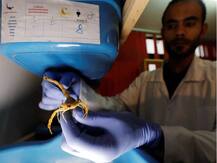 ਜ਼ਹਿਰੀਲੇ ਸੱਪਾਂ ਤੇ ਬਿੱਛੂਆਂ ਜ਼ਰੀਏ ਅਮੀਰ ਬਣਿਆ ਨੌਜਵਾਨ, ਸੱਤ ਲੱਖ ਰੁਪਏ ਪ੍ਰਤੀ ਗ੍ਰਾਮ ਵੇਚਦਾ ਜ਼ਹਿਰ