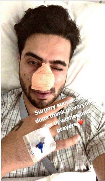 YHM's Romi aka Aly Goni undergoes surgery, his late night bleeding nose pic-posts worry fans!