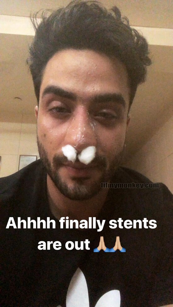 YHM's Romi aka Aly Goni undergoes surgery, his late night bleeding nose pic-posts worry fans!