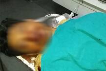 સુરતઃ કાકી-ભત્રીજાના સેક્સસંબંધમાં ગુપ્તાંગ કાપવાની ઘટનામાં નવો ધડાકોઃ  પ્રેમિકા કાકીએ શું કર્યો દગો? જાણો