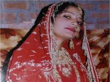 UP: પતિ કરતો હતો શંકા, યુવતીએ જાતે ચહેરો સળગાવી દીધો