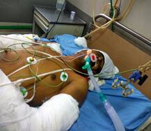 અ\'વાદઃ કસાઇની કારમાંથી મળ્યા વાછરડાં, ગૌરક્ષકોએ ઢોર માર મારી પતાવી દીધો