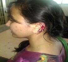 7 મહિનાથી અલગ રહેતા પતિએ પત્ની પર કર્યો હુમલો, પત્નીનો કપાયો કાન