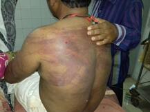 સુરેંદ્રનગરઃ સોની વેપારીને ઢોર માર મારી બે સોનાની વીંટી અને રોકડ રકમ લૂંટી લેવાઇ