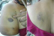 અમદાવાદઃ પોલીસે જાતિય સતામણી કરનારા લુખ્ખાઓને કંઇ ન કરતાં યુવતીનો આપઘાત