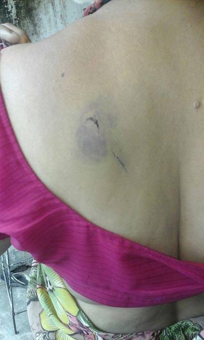 ગઈ કાલે સુરૈયાબાનુના આપઘાત પછી પરિવારે મૃતદેહ નહીં સ્વીકારવાની જીદ કરતા પોલીસ દોડતી થઈ ગઈ હતી. આ પરિવારે ઉચ્ચ પોલીસ અધિકારીઓને પણ અરજી કરી હતી. આ અરજીમાં આક્ષેપ કરાયો છે કે,જ્યારે બંને બહેનોએ ફારુકનો સતત વિરોધ કરવાનું શરૂ કર્યું ત્યારે ફારૂકે સુરૈયાબાનુ પર હુમલો કર્યો અને તેને હાથની આંગળીમાં ફ્રેક્ચર કરી દીધું હતું. આ વાતની જાણ અંતે પોલીસને કરી તો પોલીસે સામાન્ય કલમ હેઠળ ગુનો નોંધીને કાર્યવાહી કરી હતી. કલમ હળવી હોવાથી ફારુક અને તેના મદદગાર તરત છુટી ગયા હતા. 