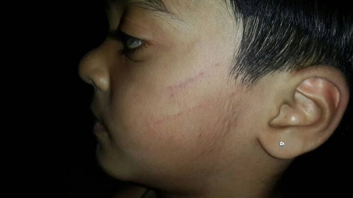 અમદાવાદઃ અમદાવાદના નરોડા વિસ્તારમાં એક માસુમ વિદ્યાર્થીને માર મરાતા શિક્ષિકાની બર્બરતા સામે આવી છે. અમદાવાદના નરોડા વિસ્તારમાં ટ્યુશન જતા કેજીના વિદ્યાર્થીને શિક્ષિકાએ માર મારતા વિદ્યાર્થીના શરીર પર ઉઝરડા પડી ગયા છે.