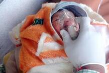 અમદાવાદઃ લેપટોપ બેગમાંથી મળી આવી નવજાત બાળકી, ધનિક યુવતીએ ત્યજી હોવાની આશંકા