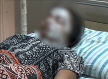 નવસારીઃ પટેલ યુવતી પર મુસ્લિમ યુવકે ફેંક્યો એસિડ, એકતરફી પ્રેમમાં હતો પાગલ, પહેલાં પણ કરેલો હુમલો