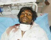 મા અંબાજીને બલિ ચઢાવવા યુવકે પોતાના જ ગળા પર ફેરવી દીધું ચાકુ, જાણો પછી શું થયું?