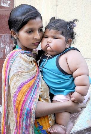 Amritsar: Chahat, an eight-month old baby suffering from obesity in Amritsar on April 15, 2017. Her weight is said to 20 kg. (Photo: IANS)