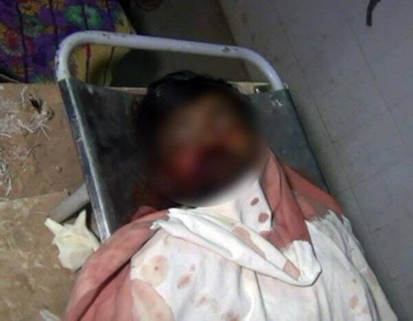 ઘટનાની જાણ થતાં આજુબાજુના ગામના રહીશો દોડી ગયા હતા. બનાવમાં કારનો કચ્ચરઘાણ નીકળી ગયો હતો. બનાવની જાણ થતાં હાર્દિક પટેલે પણ મોડી રાતે બે વાગે ઘનશ્યામગઢ પહોંચી સમગ્ર બનાવની જાત માહિતી મેળવી હતી અને આ ઘટના અકસ્માતની નહીં પણ હત્યાની હોવાનો આક્ષેપ કર્યો હતો. નવાઈની વાત તો એ છે કે કાર ઝાડ સાથે અથડાતા આ બનાવ બન્યો હોવા છતાં હાર્દિક પટેલે હત્યાનો આક્ષેપ કર્યો છે.