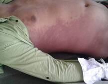 સુરતઃ બબ્બે પ્રેમી સાથે રંગરેલિયાં મનાવતી યુવતીની કામલીલાનો ભાંડો ફૂટતા પહેલા પ્રેમીને ગાર્ડનમાં બોલાવ્યો, પછી શું થયું ?