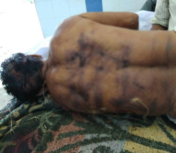 આ ઘટના 23મી મેની રાતે બની હતી. ભાણા સુખાભાઈએ મામાને તેમના ખેતર જઈને કહ્યું કે, તમે એવી કેવી પત્ની લાવી આપી છે કે જે એક જ દિવસમાં જતી રહી? આ પછી મામાને સીમમાં ખેંચી જઇને હત્યા કરી નાંખી હતી. સમગ્ર ઘટનાની જાણ પાડોશીને થતા તેમના ભત્રીજાને બોલાવી સમગ્ર ઘટના વિષે માહિતી આપી હતી. જેથી ભત્રીજાએ ભિલોડા પોલીસને જાણ કરતાં આરોપીને પકડવા ચક્રો ગતિમાન કર્યા છે.