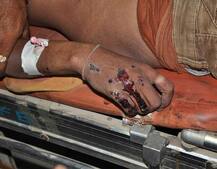 મહેસાણાઃ પાટીદારો સામે સરકારે ઝૂકવું પડયું, કેતન પટેલના અપમૃત્યના કેસમાં કરવી પડી કઈ મહત્વની જાહેરાત ?