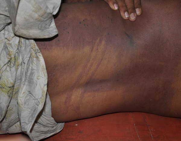 કેતનના પિતા મહેન્દ્રભાઇ પટેલ અને આગેવાનો સાથે ચર્ચા કરી જે પણ પોલીસ ફરિ્યાદ આપશો તે દાખલ કરી જવાબદારોને તાત્કાલિક ઝડપી લેવાની ખાત્રી આપી ફરી પોસ્ટમાર્ટ કરાવવા જરૂરી અરજી આપવા સમજાવ્યા હતા.જે મુજબ રાત્રે 8 વાગ્યે મહેન્દ્રભાઇ પટેલે ફરી પોસ્ટમોર્ટમ કરાય તો બીજી શરતો છોડવા તૈયારી બતાવી હતી.