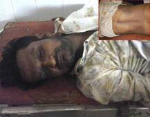 મહેસાણાઃ સ્વ. કેતન પટેલના બીજી વારના પોસ્ટ મોર્ટમમાં થયો મોટો ચોંકાવનારો ખુલાસો, જાણો વિગત