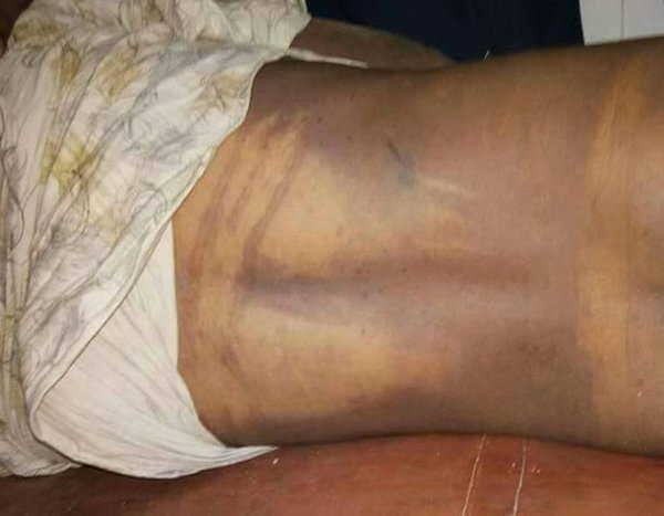 મહેસાણા સિવિલથી રવિવારે સવારે 8 વાગે કેતનની સ્મશાન યાત્રા નીકળી છે. આ અંતિમયાત્રા રાધનપુર ચોકડીથી પાંચોટના માર્ગે નુગર બાયપાસથી મીઠા- સામેત્રા થઇને બલોલ પહોંચશે. કેતન પટેલના પિતા મહેન્દ્રભાઇ નાજુક તબિયતને કારણે સીધા સ્મશાને પહોંચી પુત્રને અગ્નિ સંસ્કાર આપશે.