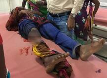 વડોદરાઃ મગરને માત આપીને મોતના મુખમાંથી કઈ રીતે પાછી આવી યુવતી? જાણો