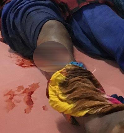 મગરનો હુમલો થતાં જ વિદ્યાએ બુમાબુમ કરી હતી. જોકે, પછી વિદ્યાએ હિમ્મત ભેગી કરીને મગરના મોઢા અને આંખ પર મુક્કા મારવાના શરૂ કરી દીધા હતા. જેને કારણે મગર ડરી ગયો હતો અને પગ છોડી દીધો હતો. જેનો લાભ લઈને યુવતી ઝડપથી બહાર આવી ગઈ હતી. આ સમયે બુમાબુમ સાંભળીને તેને બહેન સુધા તેની મદદે દોડી આવી હતી. જોકે, આ પહેલા વિદ્યા મગરથી બચી ગઈ હતી. 