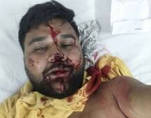 25 આતંકીઓએ બસને ઘેરી લીધી હતી, જાણો કેવી રીતે ડ્રાઈવરે 45 લોકોનો જીવ બચાવ્યો