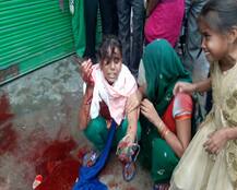 UP: છેડતીનો વિરોધ કરવા પર તલવારથી યુવતીનો હાથ કાપી નાખ્યો