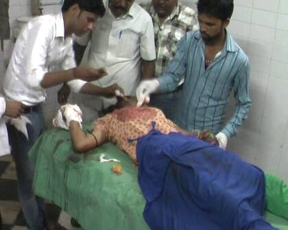 જ્યારે યુવકે યુવતી પર હુમલો કર્યો ત્યારે તે બૂમો પાડવા લાગી હતી પરંતુ તેનો બચાવવા માટે કોઇ પણ આગળ આવ્યું નહોતું. ત્યારબાદ આરોપીએ યુવતીનો હાથ કાપી નાખ્યો હતો અને ભાગી ગયો હતો. જ્યારે આરોપી ભાગવા લાગ્યો ત્યારે કેટલાક લોકોએ તેને પકડી લીધો હતો અને પોલીસના હવાલે કર્યો હતો. 