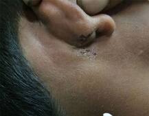 સુરતમાં વિદ્યાર્થીનું અપહરણ કર્યા બાદ આચર્યું સૃષ્ટિ વિરૂદ્ધનું કૃત્ય, ગુપ્ત જગ્યા અને કાન પર ભર્યા બચકા