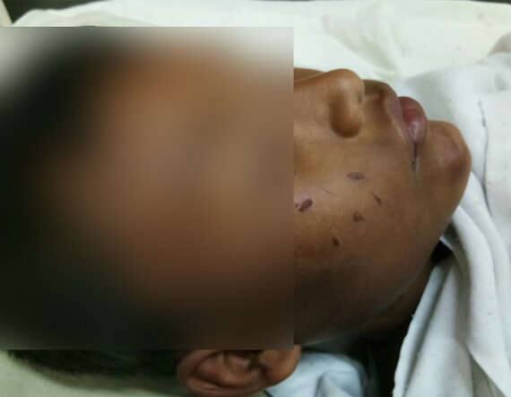 હાલ વિદ્યાર્થી સુરત સિવિલ હોસ્પિટલમાં દાખલ છે. પોલીસ તેના નિવેદન પણ લઇ ગઇ છે. એક માસૂમ સાથે થયેલા આવા કૃત્યને જોઇ ડોક્ટરો પણ ચોંકી ગયા હતા. આખા શરીર પર અસંખ્ય ઇજાના નિશાન છે. લગભગ અજાણ્યા નરાધમોએ પોતાની વાસના સંતોષવા બાળકને નિશાન બનાવ્યો હોય શકે છે. હાલ સચીન પોલીસ આ અજાણ્યા નરાધમોને શોધી રહી છે.