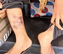 અ\'વાદનો ચકચારી કિસ્સો: દીકરીની ભણવાની જીદ સામે માતા-પિતાએ આપ્યા ડામ