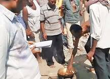 કોંગ્રેસ છોડીને ભાજપમાં ગયેલા કરમસી પટેલના પુત્રનું પરાક્રમ, કર્મચારીને ઉકળતા તેલમાં નંખાવ્યો હાથ, કેમ કર્યું આવું ?