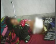 UPમાં હોસ્પીટલની બેદરકારીઃ ઓપરેશન બાદ પેટમાં જ રહેવા દીધી કાતર, મહિલાનું મોત 