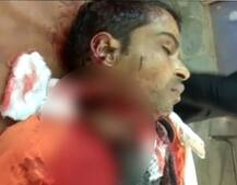 પતંગની દોરીથી ગળુ કપાતા મહેસાણાના યુવાનનું મોત, પાદરામાં બે વ્યક્તિ ગંભીર