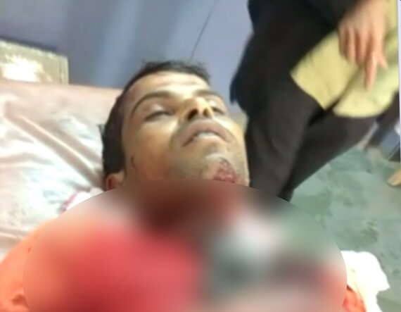 માહિતી પ્રમાણે, મહેસાણાના ગોઝારિયા ચાર રસ્તાં પરથી એક 33 વર્ષીય યુવાન પસાર થઇ રહ્યો હતો. ત્યાં અચાનક ગળાના ભાગમાં પતંગની દોરી ફસાઇ જતાં તેનું ઘટના સ્થળે જ મોત નિપજ્યું હતું. મૃ્ત્યુ પામેલો યુવાન મહેસાણાનો કલ્પેશ પટેલ છે. 