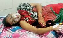 રાજકોટ: જાહેર રસ્તા પર પૂર્વ પતિએ યુવતી પર કર્યો એસિડથી એટેક, જાણો કેમ