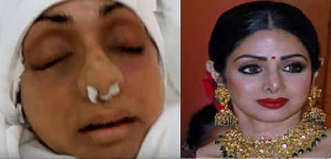 મુંબઈ: શ્રીદેવીના મૃતદેહની પહેલી તસવીર આવી સામે, સોશિયલ મીડિયા પર થઈ વાયરલ! મુંબઈ: શ્રીદેવીના મૃતદેહની પહેલી તસવીર આવી સામે, સોશિયલ મીડિયા પર થઈ વાયરલ!