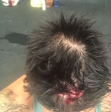 જિમમાં એક્સરસાઇઝ કરતી વખતે ઘાયલ થયો આ સ્ટાર ક્રિકેટર, માથામાં લેવા પડ્યા 16 ટાંકા