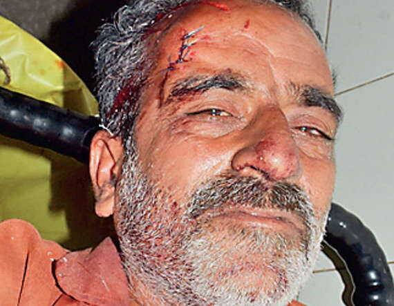 હિટ એન્ડ રનનો ભોગ બનનાર પિતા-પુત્ર બનાવના સ્થળ એટલે કે મહાકાળી ચોક પાસે રહેતા હતાં અને કેબીન ચલાવી ગુજરાન ચલાવતા હોવાનું પોલીસની પ્રાથમિક તપાસમાં બહાર આવ્યું છે. પિતા-પુત્ર બને એકલા રહેતા હોય પિતાનું મૃત્યુ નિપજતાં પુત્ર એકલવાયો બન્યો છે.