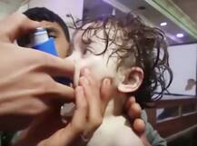 નરક બન્યુ સીરિયા, રશિયાએ છોડેલી કેમિકલ મિસાઇલોથી બાળકો પર થઇ આવી અસર, જુઓ તસવીરો