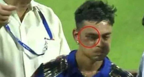 બોલ વાગવાના કારણે ઈશાનની આંખ નીચેનો ભાગ સોજીને લાલ થઈ ગયો હતો.