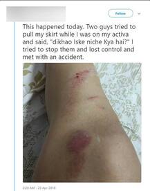 મૉડલનું સ્કર્ટ ખેંચીને બે લુખ્ખાએ પૂછ્યુઃ દિખાઓ ઈસ કે નીચે ક્યા હૈ? રોડ પર બની શરમજનક ઘટના