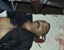 જામનગરમાં 100 કરોડના કૌભાંડનો કેસ લડી રહેલા વકીલની જાહેરમાં હત્યા, જાણો કઈ રીતે ઝનૂનથી રહેંસી નંખાયા ?