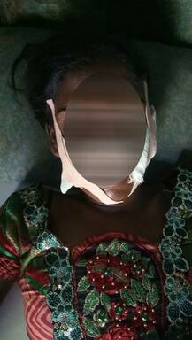 અમદાવાદઃ એવું તે શું થયું કે યુવકે પ્રેમિકાના મોઢા પર મારી દીધા છરીના ઘા?